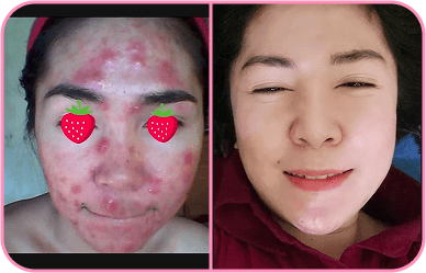 Comment image 1