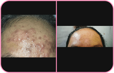 Comment image 1
