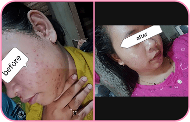 Comment image 1