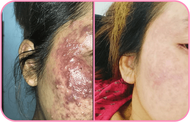 Comment image 1