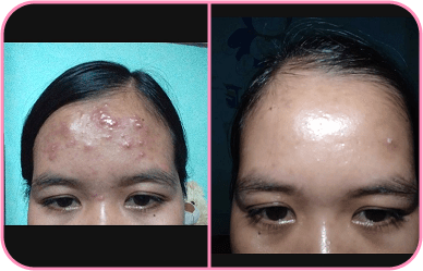 Comment image 1