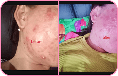 Comment image 1